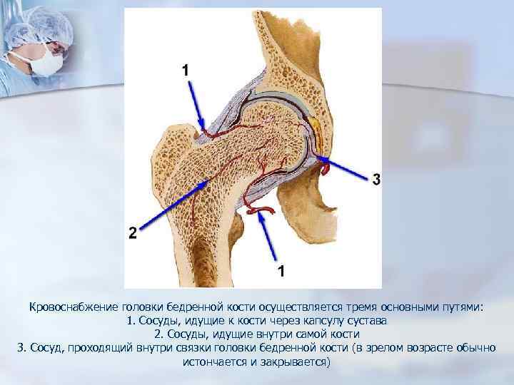 Головка бедренной