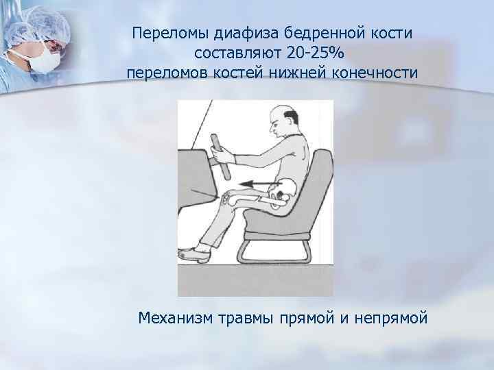 Переломы диафиза бедренной кости составляют 20 -25% переломов костей нижней конечности Механизм травмы прямой