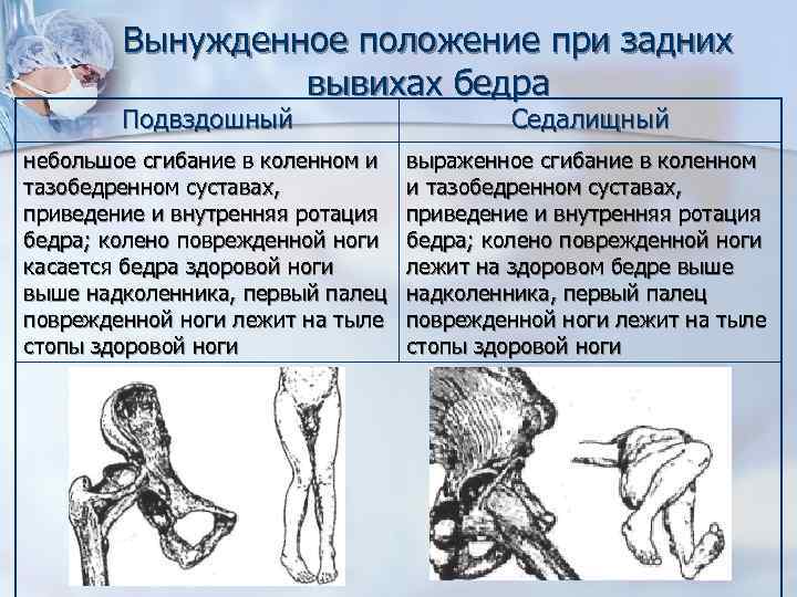 Растяжение связок тазобедренного сустава карта вызова