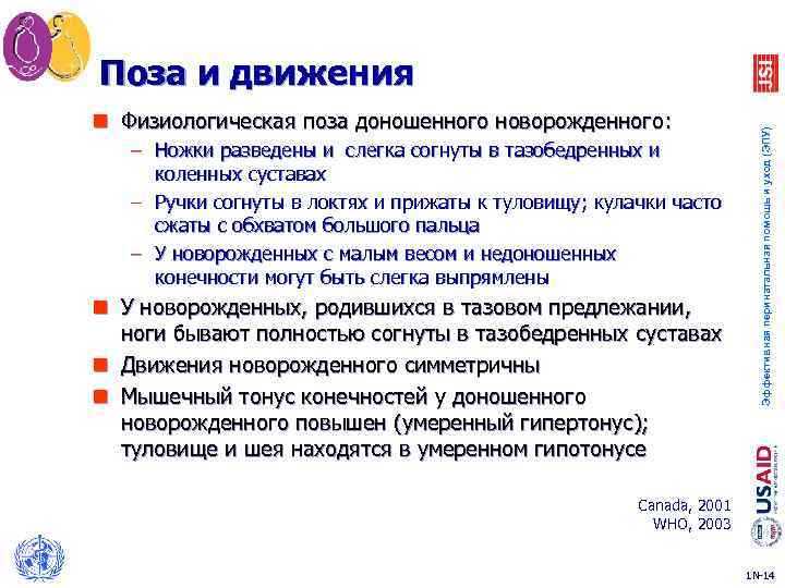 n Физиологическая поза доношенного новорожденного: – Ножки разведены и слегка согнуты в тазобедренных и