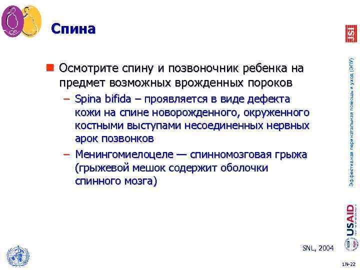 n Осмотрите спину и позвоночник ребенка на предмет возможных врожденных пороков – Spina bifida