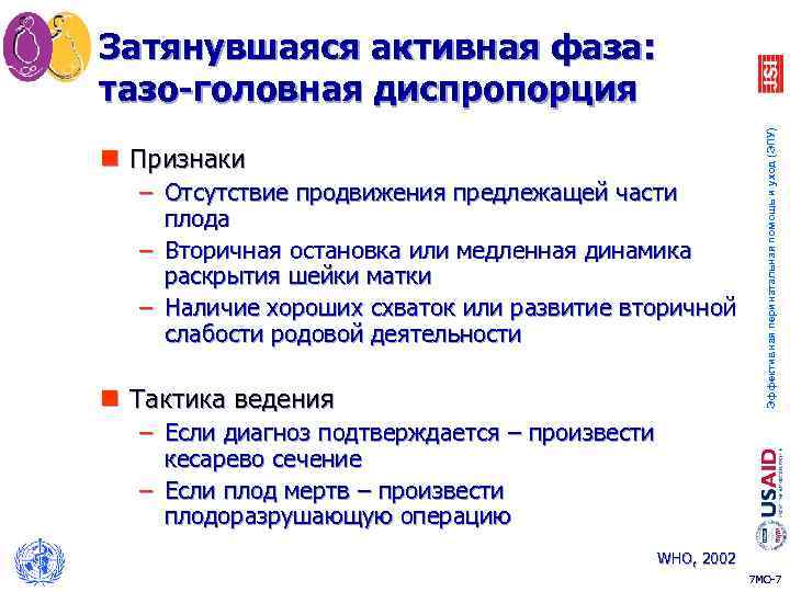 n Признаки – Отсутствие продвижения предлежащей части плода – Вторичная остановка или медленная динамика