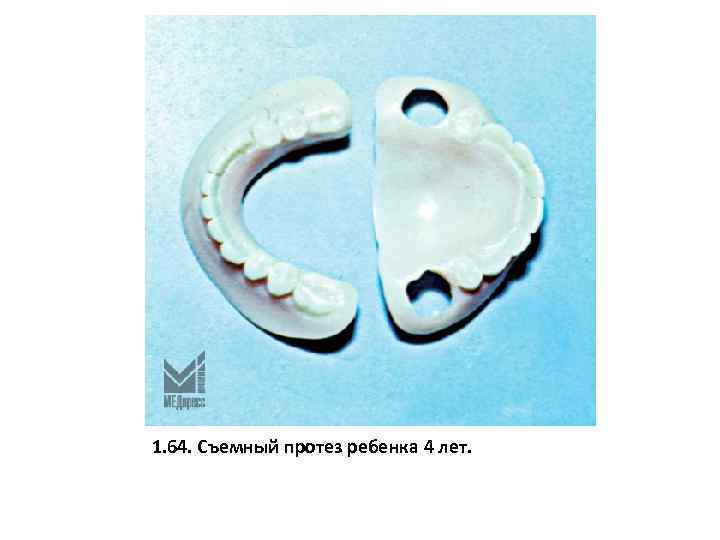 1. 64. Съемный протез ребенка 4 лет. 
