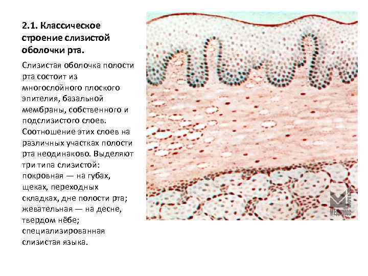 2. 1. Классическое строение слизистой оболочки рта. Слизистая оболочка полости рта состоит из многослойного