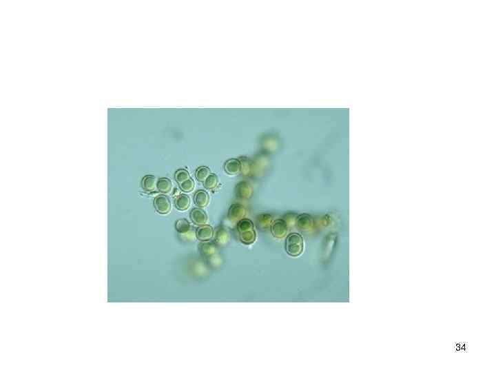 34 