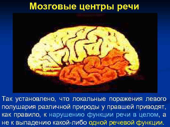 Мозговые центры речи Так установлено, что локальные поражения левого полушария различной природы у правшей