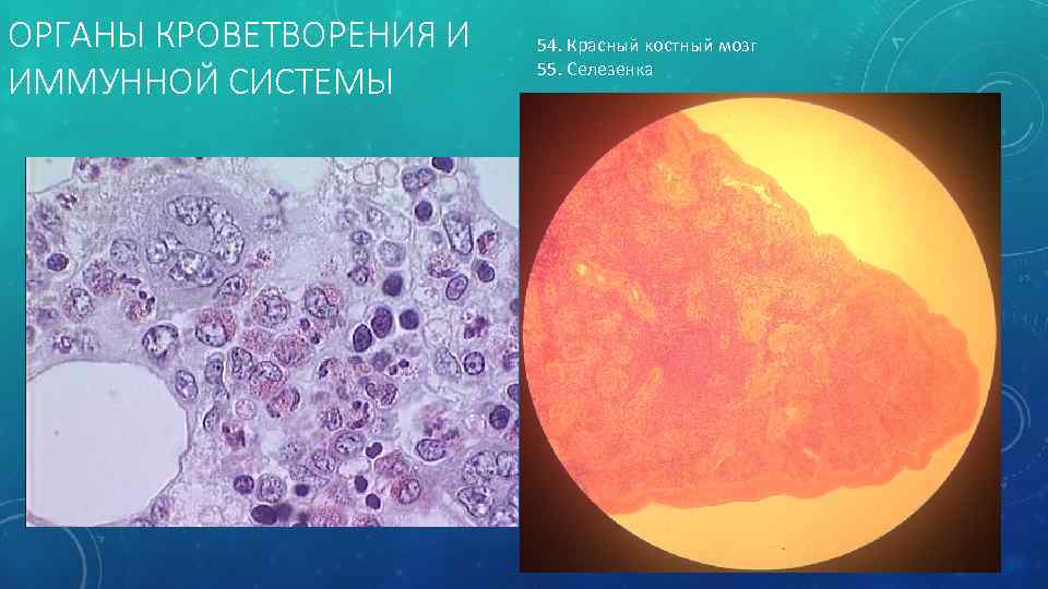 Красный мозг препарат. Красный костный мозг гистология препарат. Срез красного костного мозга препарат. Мазок красного костного мозга препарат гистология. Костный мозг гистология препарат.