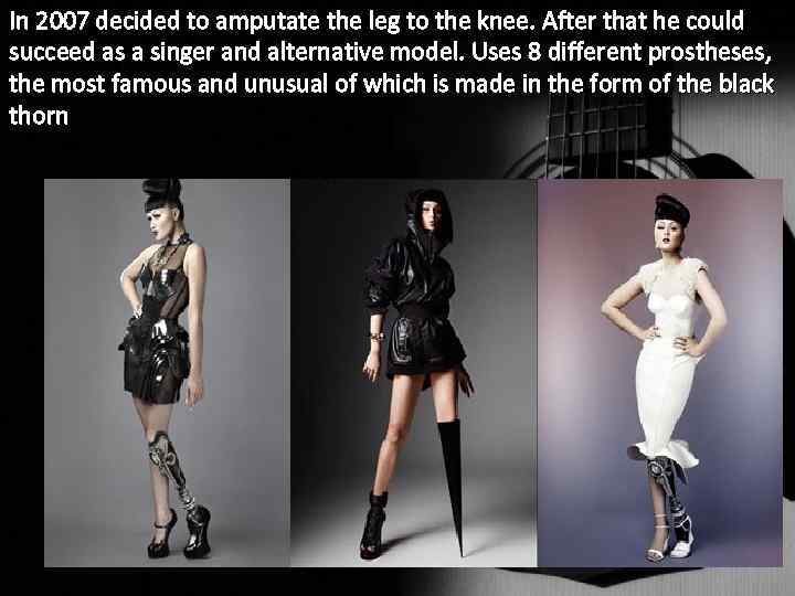 In 2007 decided to amputate the leg to the knee. After that he could