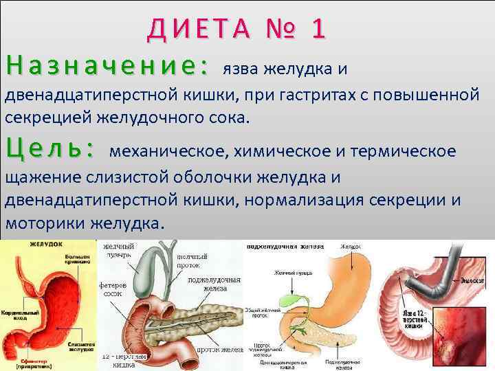  ДИЕТА № 1 Н а з н а ч е н и е