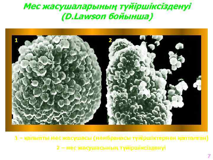 Мес жасушаларының түйіршіксізденуі (D. Lawson бойынша) 1 2 1 – қалыпты мес жасушасы (мембранасы