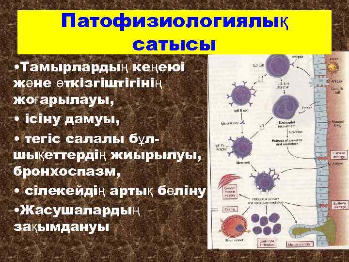 Патофизиологиялық сатысы • Тамырлардың кеңеюі және өткізгіштігінің жоғарылауы, • ісіну дамуы, • тегіс салалы