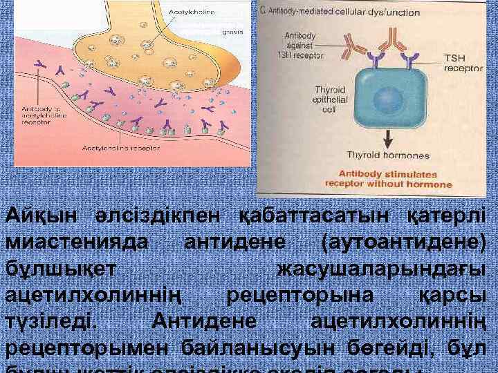 Айқын әлсіздікпен қабаттасатын қатерлі миастенияда антидене (аутоантидене) бұлшықет жасушаларындағы ацетилхолиннің рецепторына қарсы түзіледі. Антидене