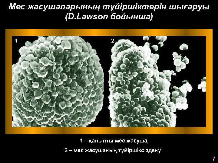 Мес жасушаларының түйіршіктерін шығаруы (D. Lawson бойынша) 1 2 1 – қалыпты мес жасуша,