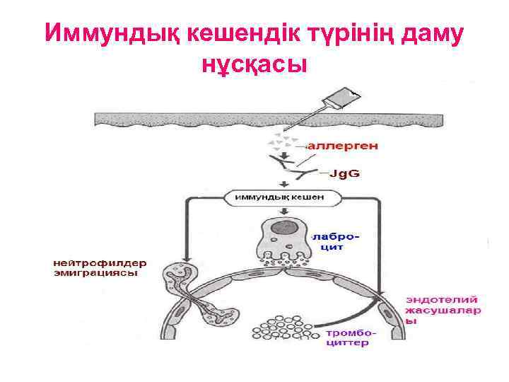 Иммундық кешендік түрінің даму нұсқасы 