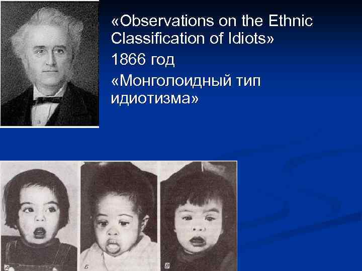  «Observations on the Ethnic Classification of Idiots» 1866 год «Монголоидный тип идиотизма» 