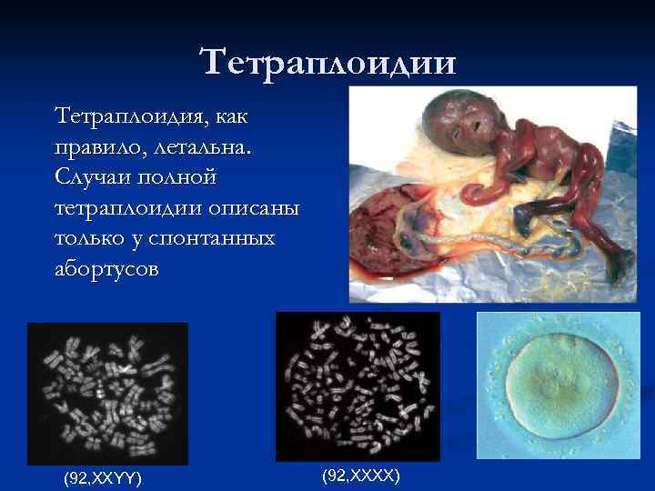 Геномные мутации презентация