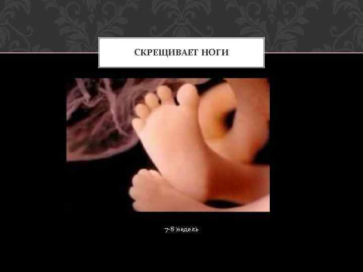 СКРЕЩИВАЕТ НОГИ 7 -8 недель 