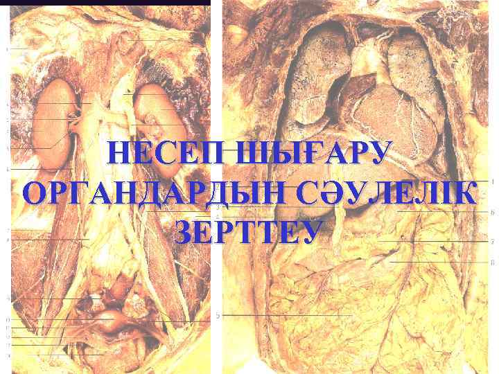 НЕСЕП ШЫҒАРУ ОРГАНДАРДЫН СӘУЛЕЛІК ЗЕРТТЕУ 