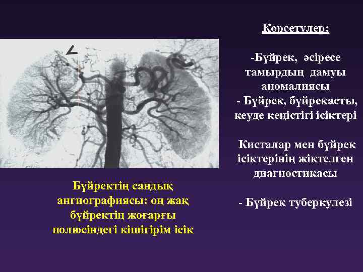 Көрсетулер: -Бүйрек, әсіресе тамырдың дамуы аномалиясы - Бүйрек, бүйрекасты, кеуде кеңістігі ісіктері Бүйректің сандық