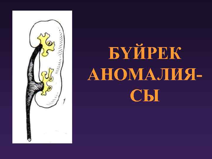 БҮЙРЕК АНОМАЛИЯСЫ 