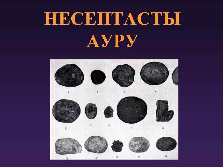 НЕСЕПТАСТЫ АУРУ 