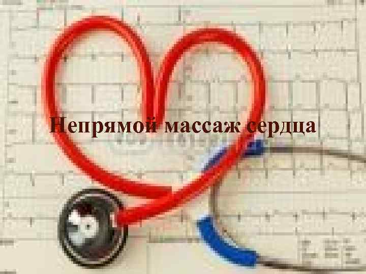 Непрямой массаж сердца 
