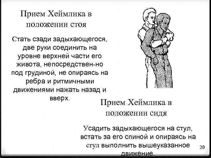 Прием Хеймлика в положении стоя Стать сзади задыхающегося, две руки соединить на уровне верхней