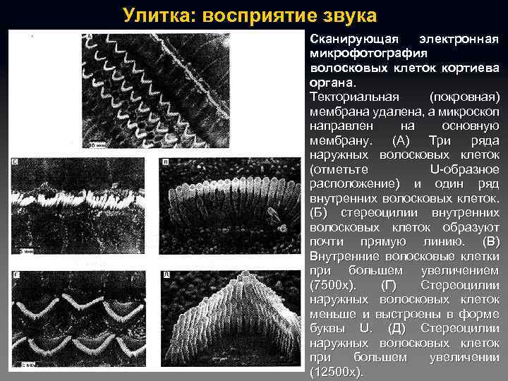 Улитка: восприятие звука Сканирующая электронная микрофотография волосковых клеток кортиева органа. Текториальная (покровная) мембрана удалена,