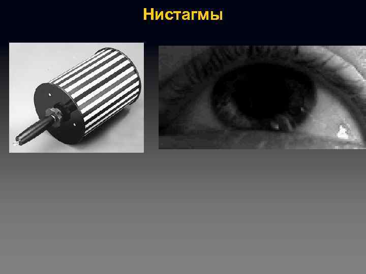 Нистагмы 