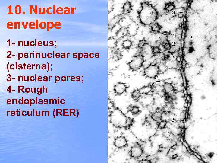 10. Nuclear envelope 1 - nucleus; 2 - perinuclear space (cisterna); 3 - nuclear