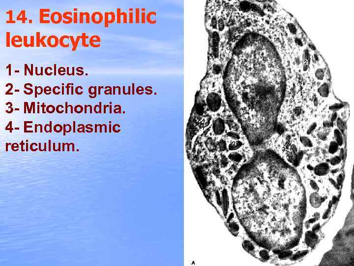 14. Eosinophilic leukocyte 1 - Nucleus. 2 - Specific granules. 3 - Mitochondria. 4