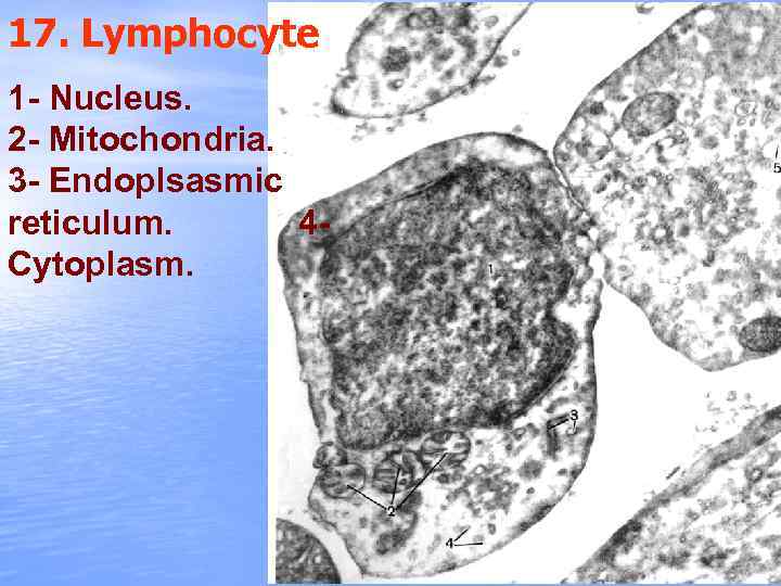 17. Lymphocyte 1 - Nucleus. 2 - Mitochondria. 3 - Endoplsasmic reticulum. 4 Cytoplasm.