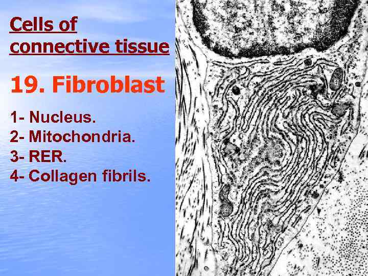 Cells of connective tissue 19. Fibroblast 1 - Nucleus. 2 - Mitochondria. 3 -