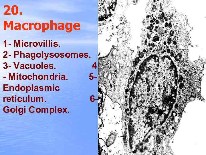 20. Macrophage 1 - Microvillis. 2 - Phagolysosomes. 3 - Vacuoles. 4 - Mitochondria.