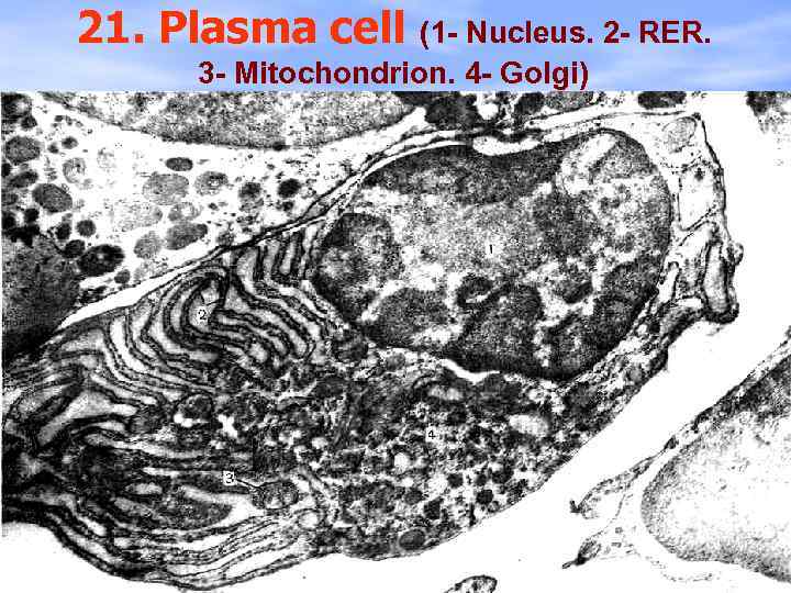 21. Plasma cell (1 - Nucleus. 2 - RER. 3 - Mitochondrion. 4 -