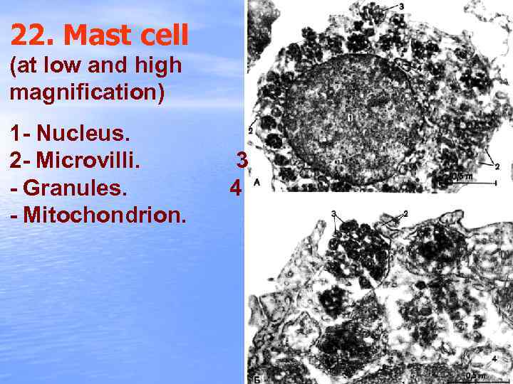 22. Mast cell (at low and high magnification) 1 - Nucleus. 2 - Microvilli.