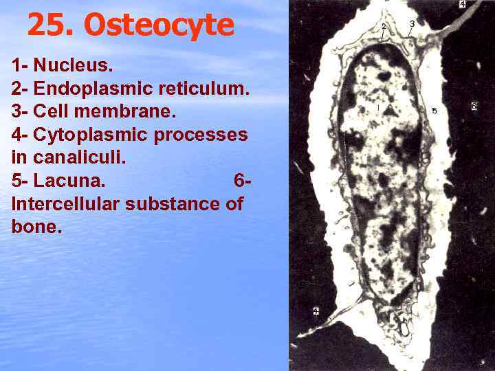 25. Osteocyte 1 - Nucleus. 2 - Endoplasmic reticulum. 3 - Cell membrane. 4