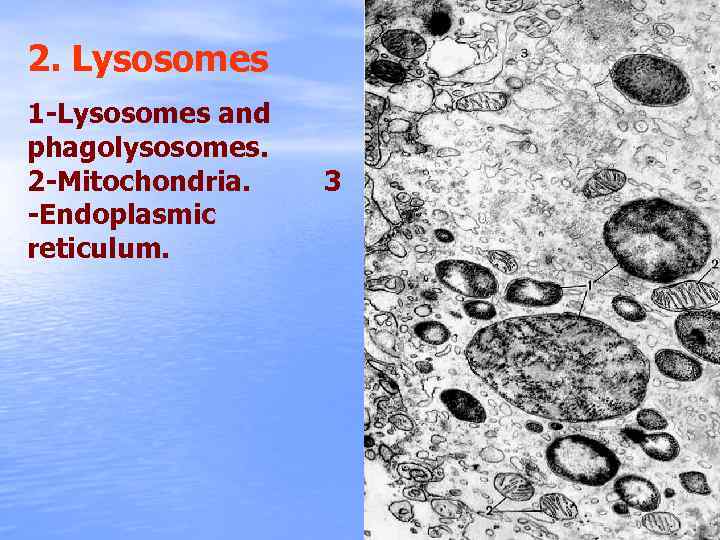 2. Lysosomes 1 -Lysosomes and phagolysosomes. 2 -Mitochondria. -Endoplasmic reticulum. 3 