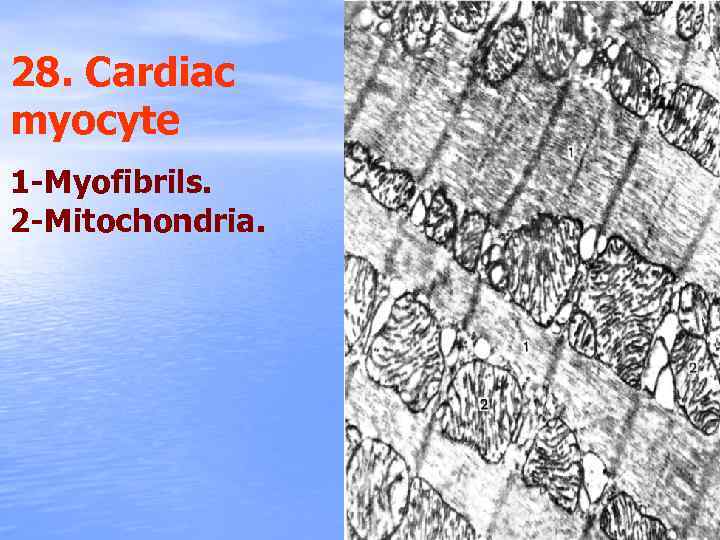 28. Cardiac myocyte 1 -Myofibrils. 2 -Mitochondria. 
