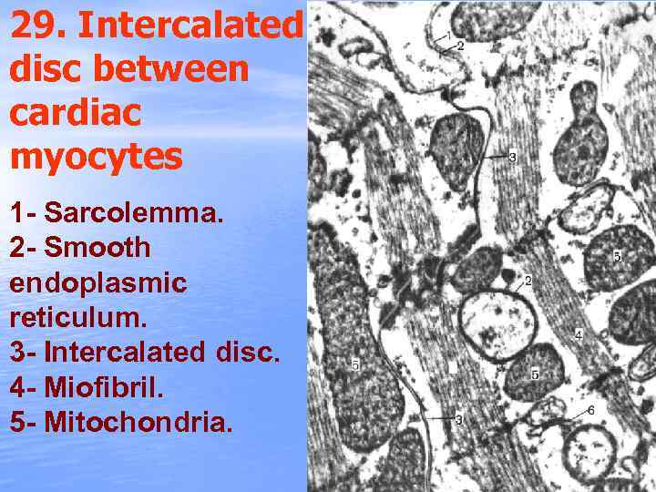 29. Intercalated disc between cardiac myocytes 1 - Sarcolemma. 2 - Smooth endoplasmic reticulum.
