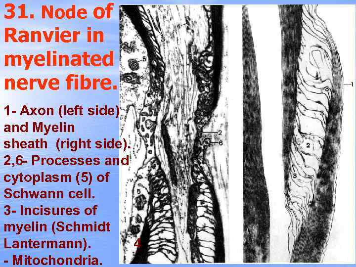 31. Node of Ranvier in myelinated nerve fibre. 1 - Axon (left side) and