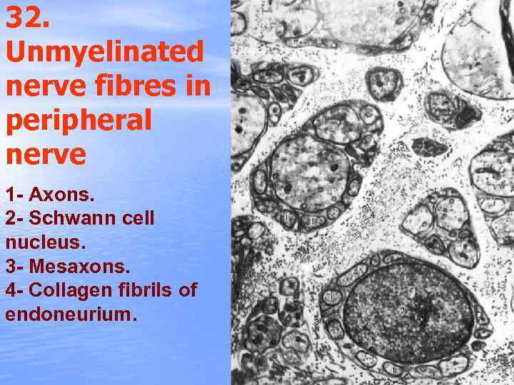 32. Unmyelinated nerve fibres in peripheral nerve 1 - Axons. 2 - Schwann cell
