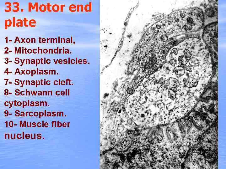 33. Motor end plate 1 - Axon terminal, 2 - Mitochondria. 3 - Synaptic