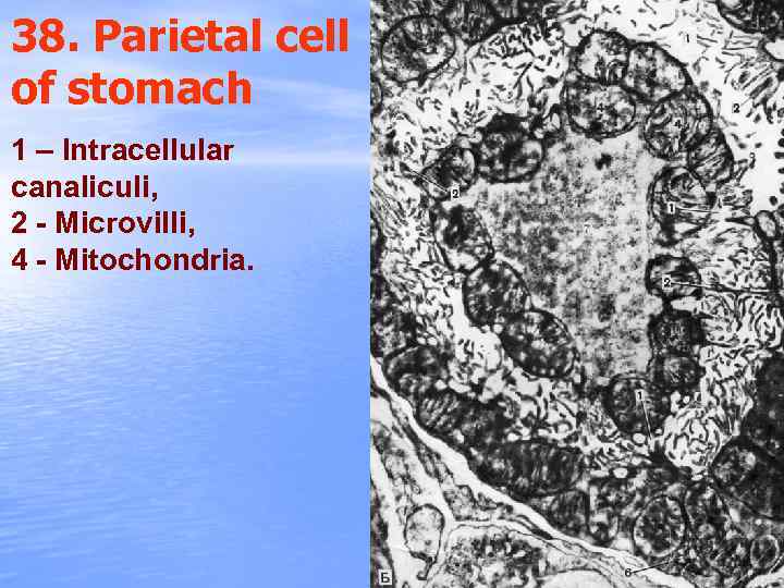 38. Parietal cell of stomach 1 – Intracellular canaliculi, 2 - Microvilli, 4 -