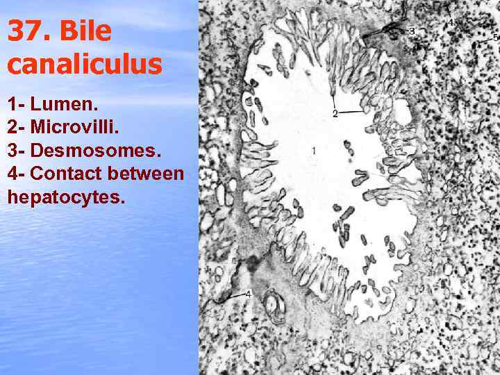 37. Bile canaliculus 1 - Lumen. 2 - Microvilli. 3 - Desmosomes. 4 -