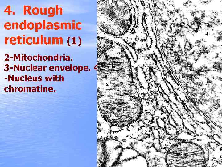 4. Rough endoplasmic reticulum (1) 2 -Mitochondria. 3 -Nuclear envelope. 4 -Nucleus with chromatine.
