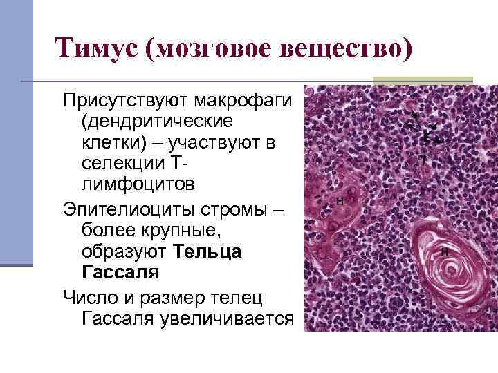 Тимус (мозговое вещество) Присутствуют макрофаги (дендритические клетки) – участвуют в селекции Тлимфоцитов Эпителиоциты стромы