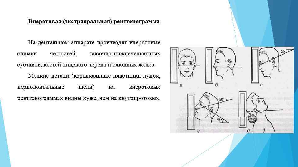 Возрастные особенности изображения зубов и челюстей в норме на рентгенограммах