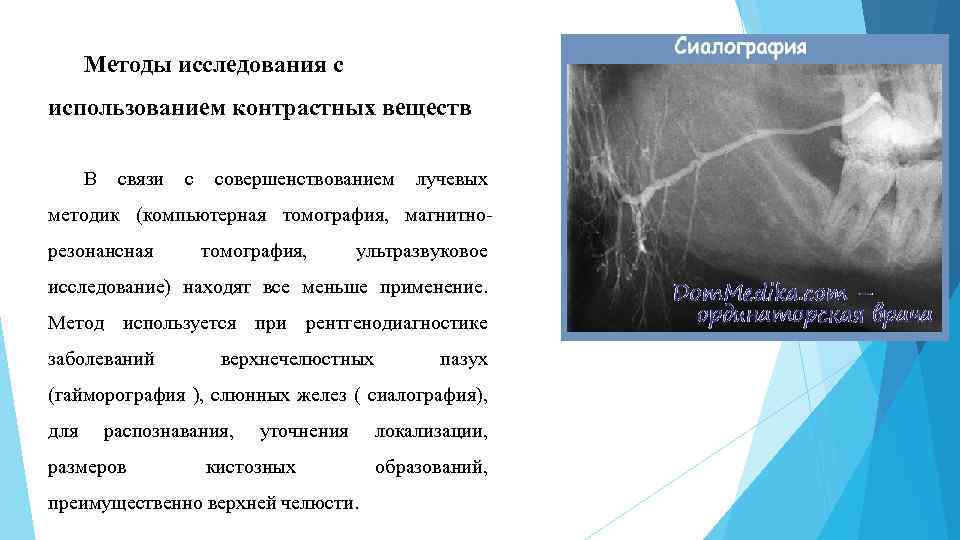 Метод вещество. Контрастные методы исследования лучевая диагностика. Методики кт исследования. . Методы исследования с использованием контрастных веществ.. Рентгенологические контрастные методы исследования.
