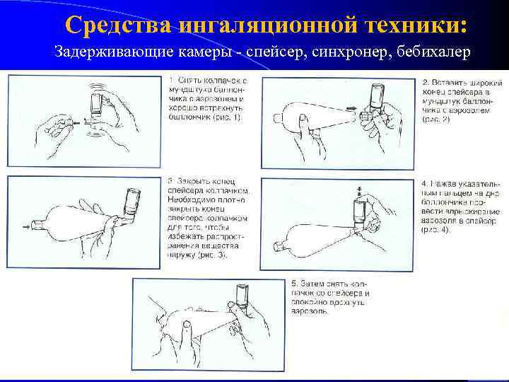 Средства ингаляционной техники: Задерживающие камеры - спейсер, синхронер, бебихалер 